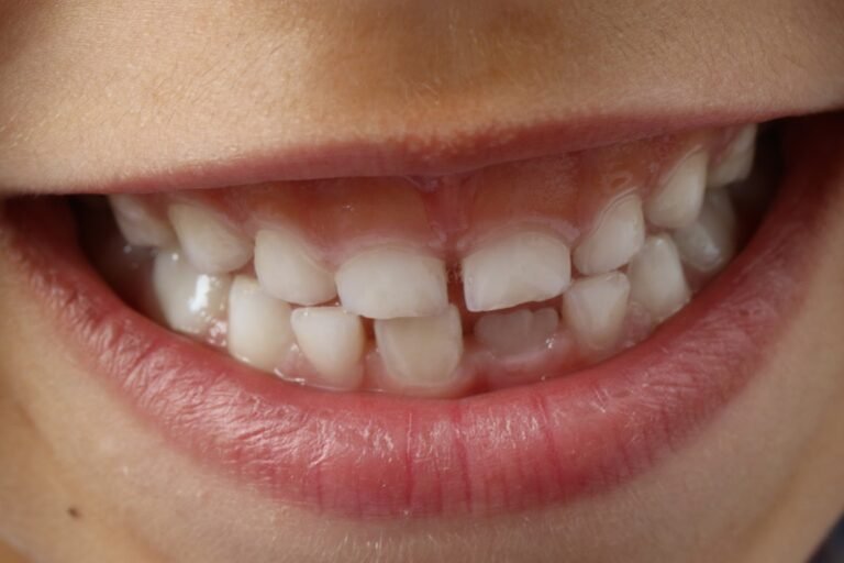 अकल दाढ़ किसे कहते हैं | अकल दाढ़ क्या है | What is a wisdom tooth in hindi